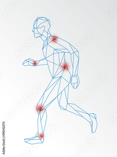 Vector medical illustration of joint pain demonstrated on running man