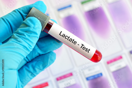 Test tube with blood sample for lactate test
 photo