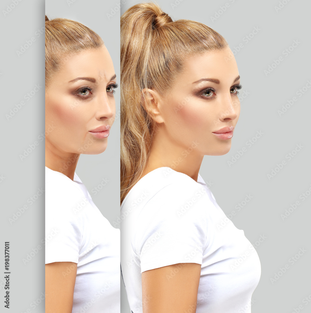 Aging. Mature woman-young woman.Face with skin problem.Before and after cosmetic procedures Aging. Mature woman-young woman.Face with skin problem.Before and after cosmetic procedures