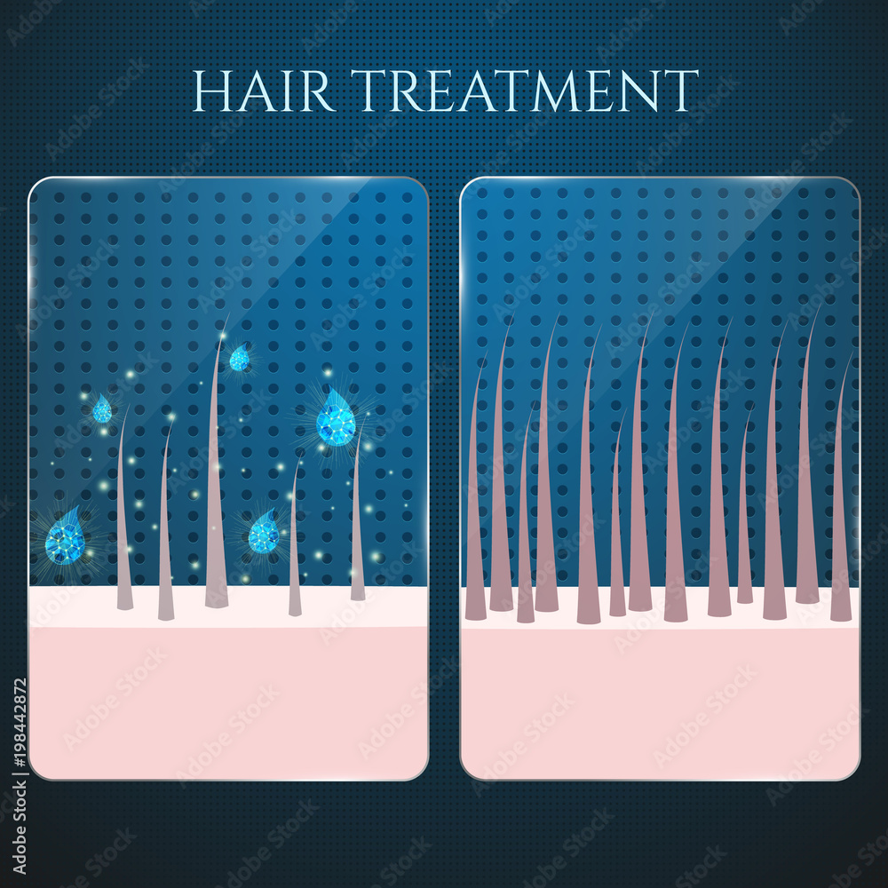 Healthy and damaged hair under the microscope. Closeup view. Scalp care