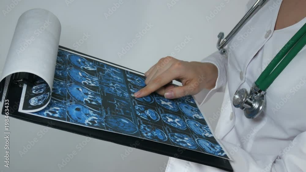 Medicina Rengen The doctor diagnoses with rengen in the modern office. Filling the ...