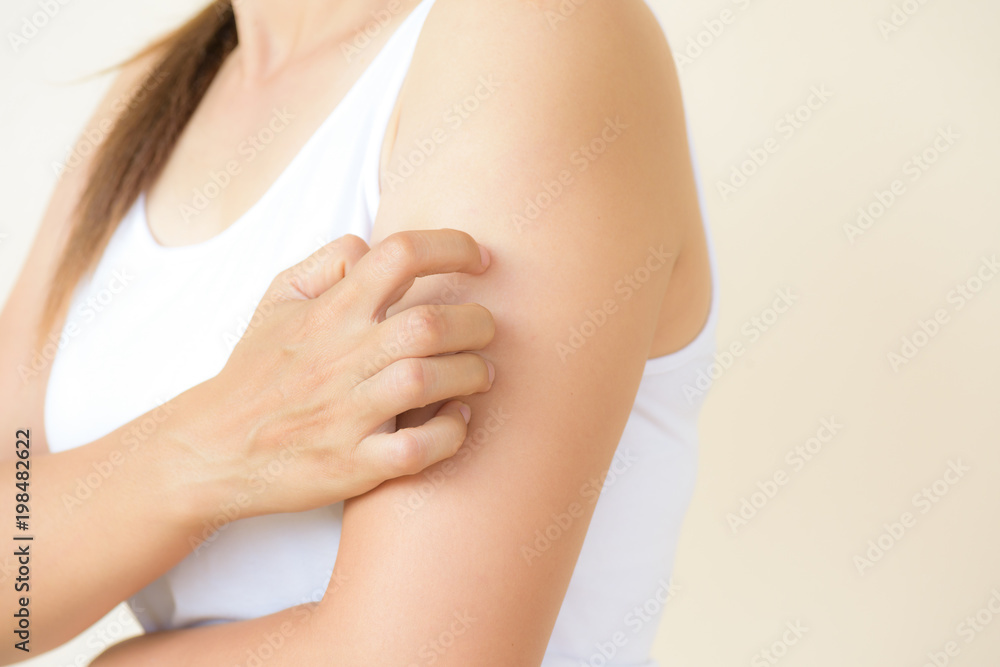 Close up woman arm scratch the itch by hand at home. Healthcare and medical concept.