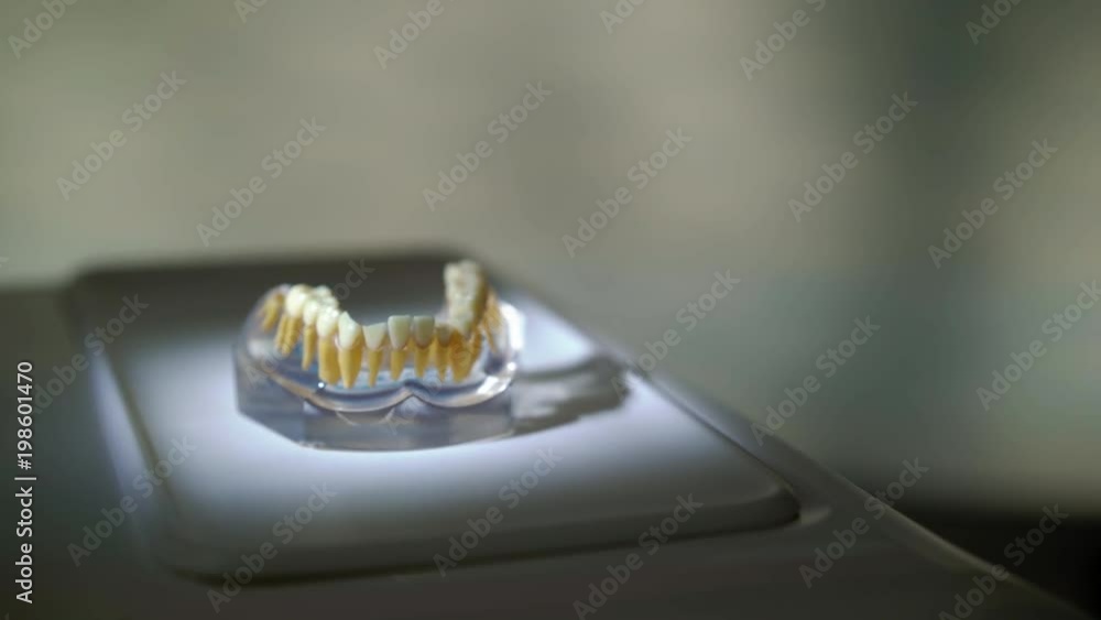 Jaw tooth in dental clinic Jaw tooth in dental clinic