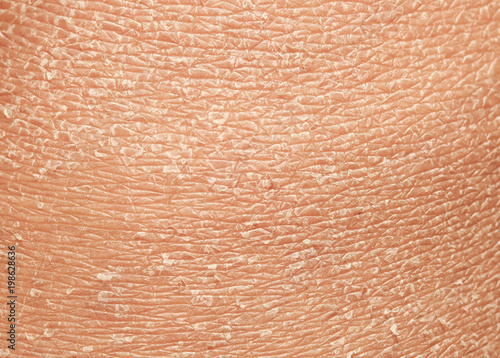Фотография texture of the epidermis of human skin with flakes and cracked particles closeu