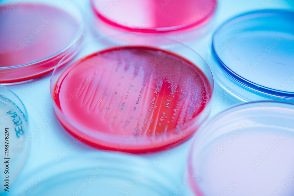 differents cultivation in petri dishes in laboratory differents cultivation in petri dishes in laboratory