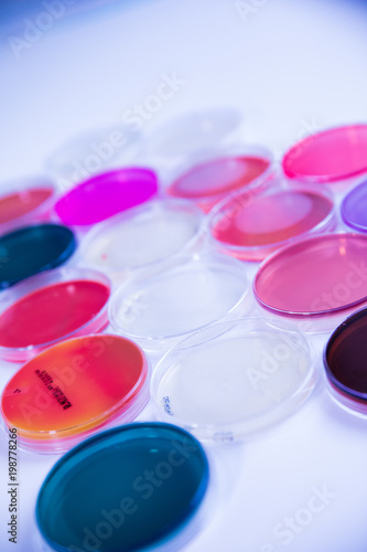 differents cultivation in petri dishes in laboratory