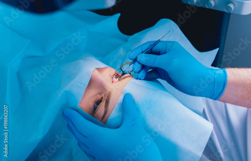 Laser vision correction. A patient in the operating room during ophthalmic surgery. Eyelid speculum. Lasik treatment.