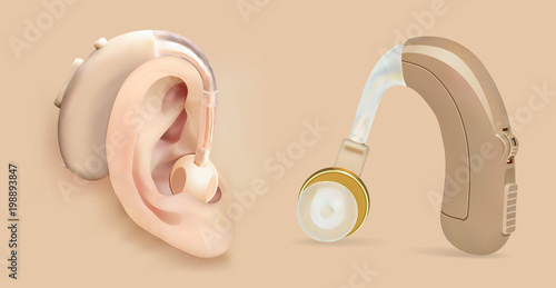Vector hearing aid behind the ear. Sound amplifier for patients with hearing loss. Treatment and prosthetics in otolaryngology. Medicine and health. Realistic object.