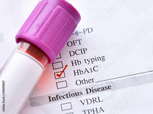 Blood sample for HbA1c test, diabetes diagnosis  photo