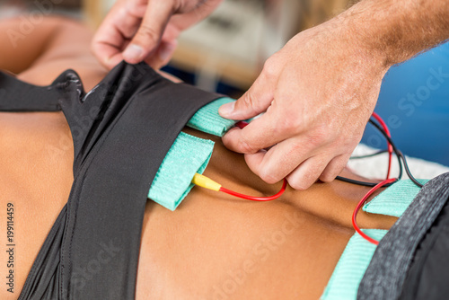 Electrical stimulation in physical therapy. Therapist positioning electrodes onto a female athlete s lower back muscles