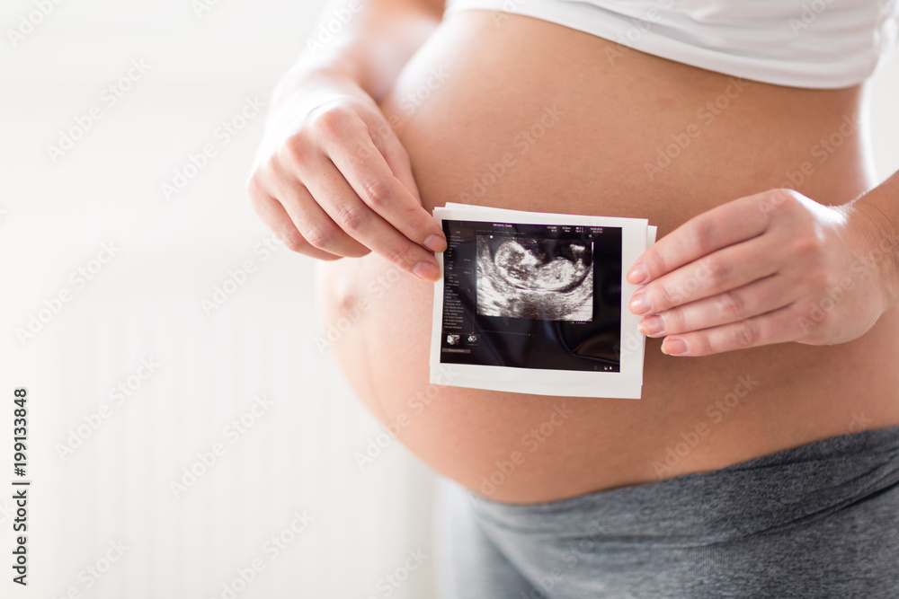 Pregnant woman holding ultrasound photo on belly Pregnant woman holding ultrasound photo on belly