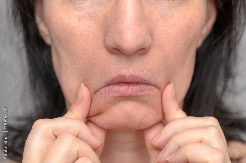 Woman pulling down the sides of her mouth Woman pulling down the sides of her mouth