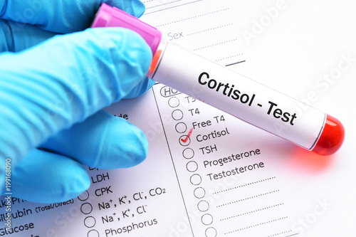 Blood sample for cortisol hormone test photo