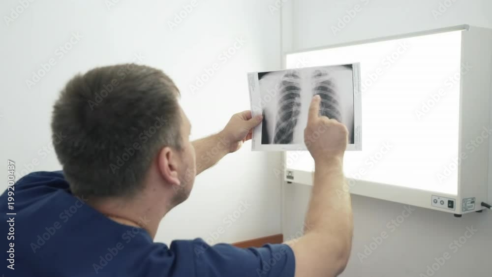 adult doctor holds in his hand and discusses an x-ray photograph. A man in a doctor's clothes examines a photo on medical equipment in a hospital. adult doctor holds in his hand and discusses an x-ray photograph. A man in a doctor's clothes examines a photo on medical equipment in a hospital.