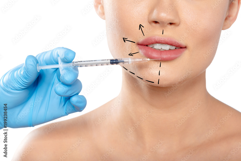 woman with dotted lines on face, cosmetology woman with dotted lines on face, cosmetology
