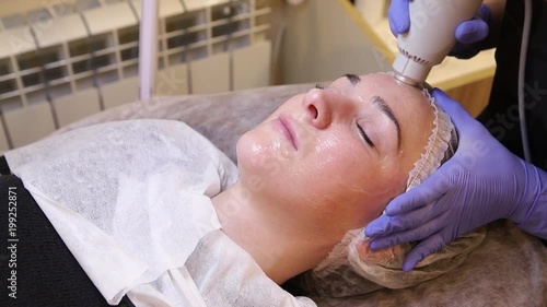 Procedure cryotherapy of the facial skin photo