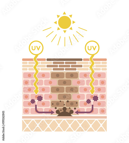 mechanism of skin pigmentation / skin spot illustration (no text)