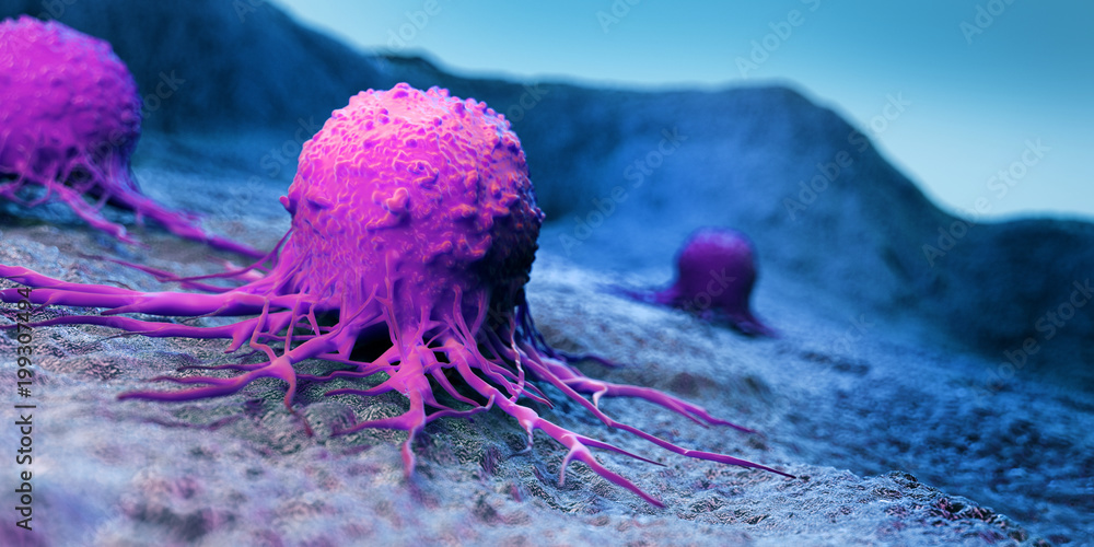3d rendered medically accurate illustration of a cancer cell - obrazy, fototapety, plakaty 