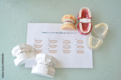 歯科模型とスマイルチャート