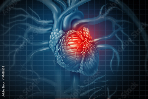 Картината върху платно Heart Attack