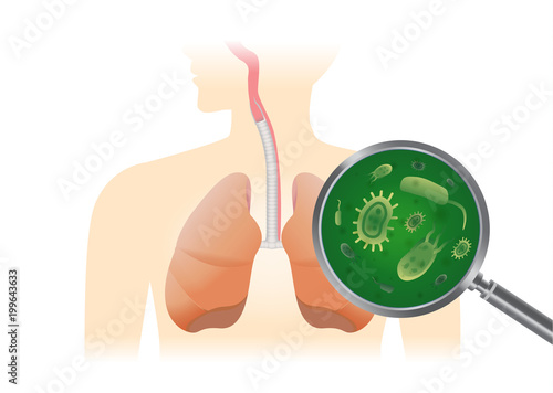 Finding virus in the human lung with a magnifier. Medical illustration about Viral Pneumonia.