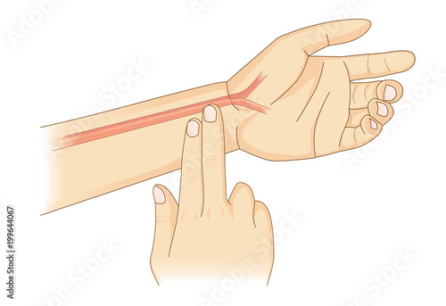 Checking Your Heart Rate Manually with place two fingers at wrist. Illustration about health diagnose.