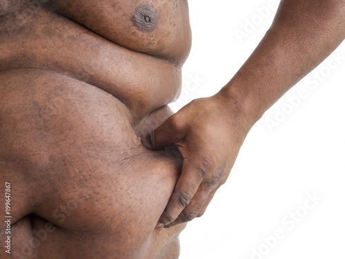 Overweight man pinching body fat on his waist photo