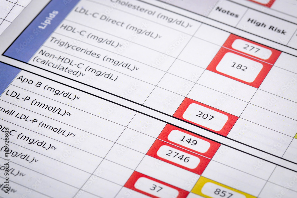 high risk cholesterol test results