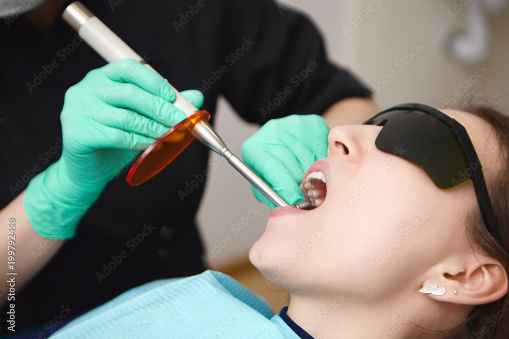 Cropped shot of woman patient wearing protective black eyeglasses opening mouth widely during dental procedure conducted in her oral cavity by unrecognizable female dentist or orthodontist Cropped shot of woman patient wearing protective black eyeglasses opening mouth widely during dental procedure conducted in her oral cavity by unrecognizable female dentist or orthodontist
