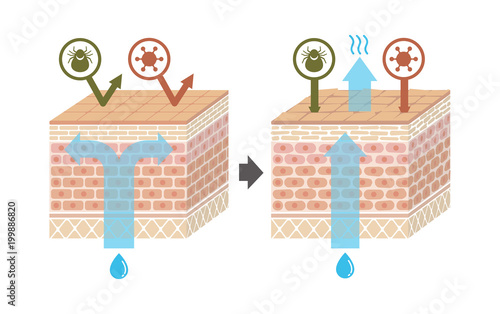 Sectional view of the skin.Comparison illustration of protection effect between healthy skin and wounded skin. No text. 