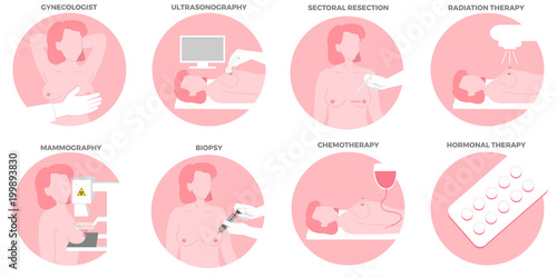 Breast Cancer Diagnostics and  Treatments set.  Medicine, pathology, anatomy, physiology, health. Vector illustration. Healthcare poster or banner template.
