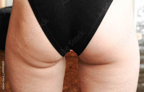 Fotografie Cellulite in women booty and legs