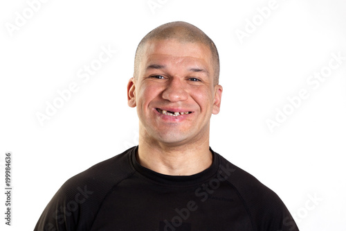 Fototapeta Bald man is smiling a toothless smile
