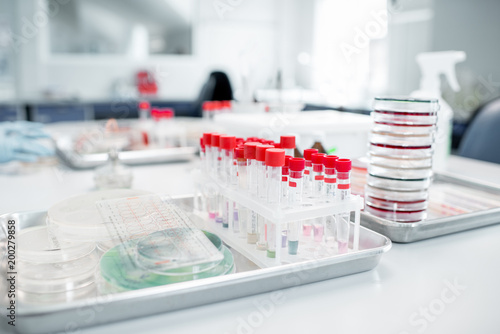 Test tubes with Petri dishes on the table in bacteriological department of laboratory