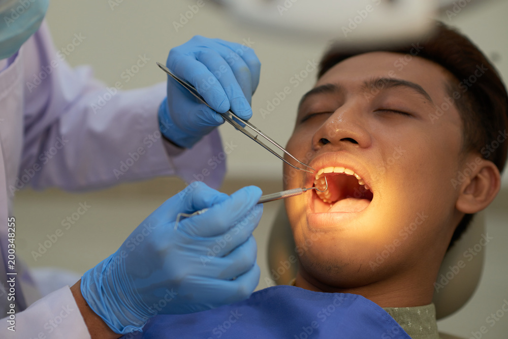 Teeth examination Teeth examination
