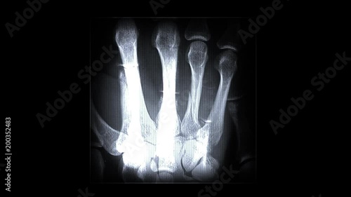 X-ray Body Parts. Alpha Channel Included.