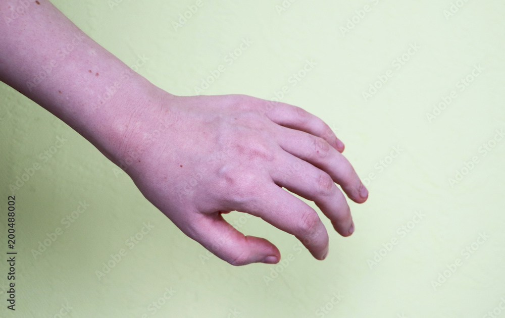 Fototapeta premium arm with visible veins