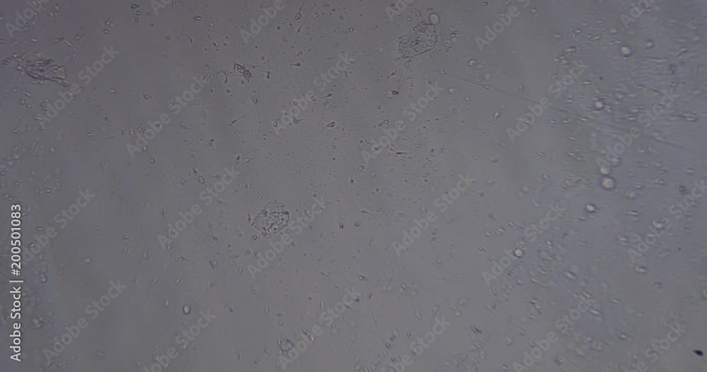 movement of active spermatozoons in sperm movement of active spermatozoons in sperm