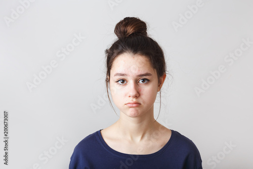portrait of a pimply teenage girl in a blue T-shirt on a gray background, sad face