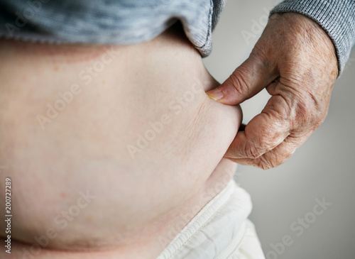 Cuadro en lienzo Closeup of obese elderly woman