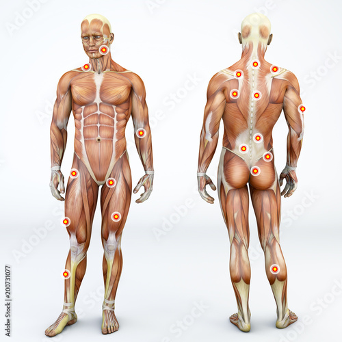 Vista frontale e di spalle di una persona ed i suoi muscoli con i trigger points evidenziati. Anatomia e corpo umano. Zone di muscolatura o fascia dense e dolorose alla palpazione