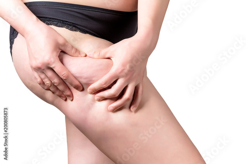 A young woman holding hands on a hip flask points to cellulite