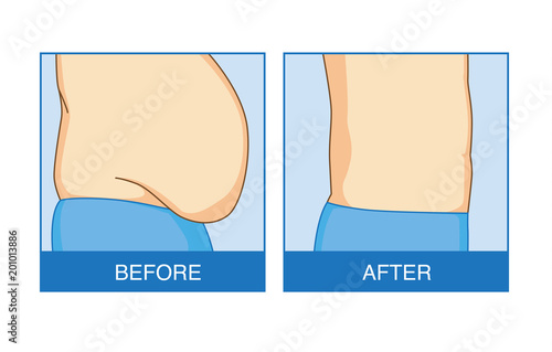Before and after of excess abdominal fat to flat. Illustration about shape and lose weight.
