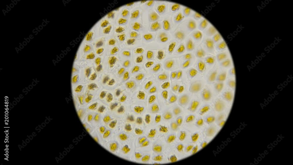 undigested cellulose of vegetables in the feces of the person under the microscope undigested cellulose of vegetables in the feces of the person under the microscope