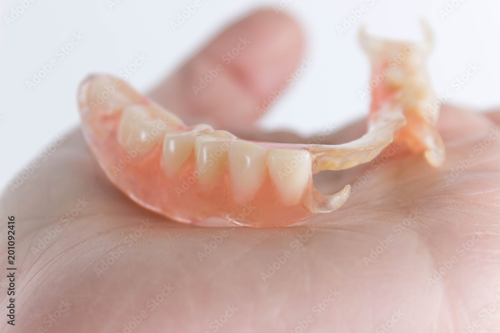 flexible nylon denture