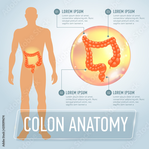 Vector colon infographics banner illustration