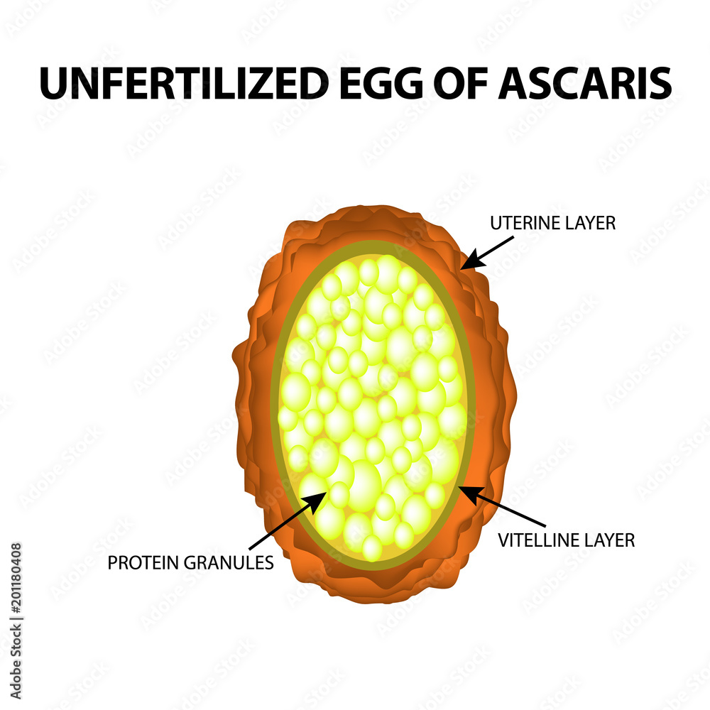 The egg of the roundworm unfertilized. Structure of Ascaris eggs ...