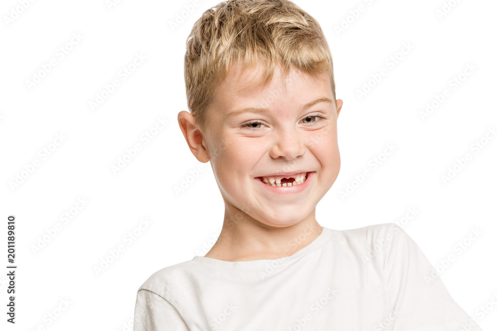 Cute little boy without anterior teeth laughing, isolated on white background Cute little boy without anterior teeth laughing, isolated on white background
