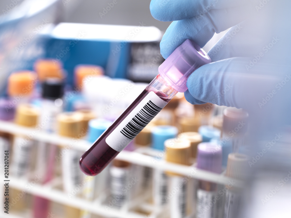 Medical technician preparing blood sample for clinical testing Medical technician preparing blood sample for clinical testing