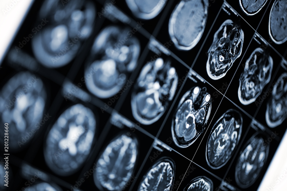 Medical background with MRI scan image of human head